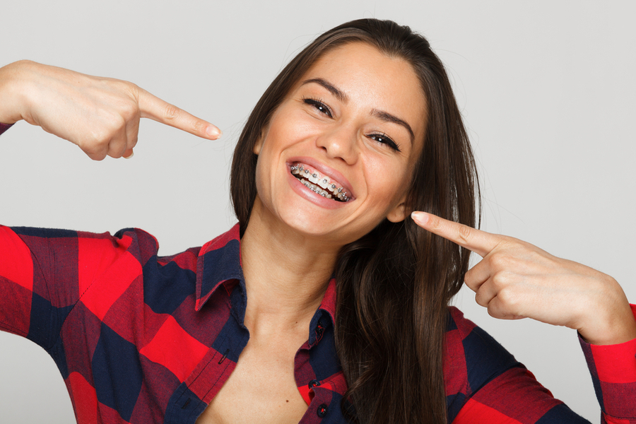 braces treatment for a girl smiling